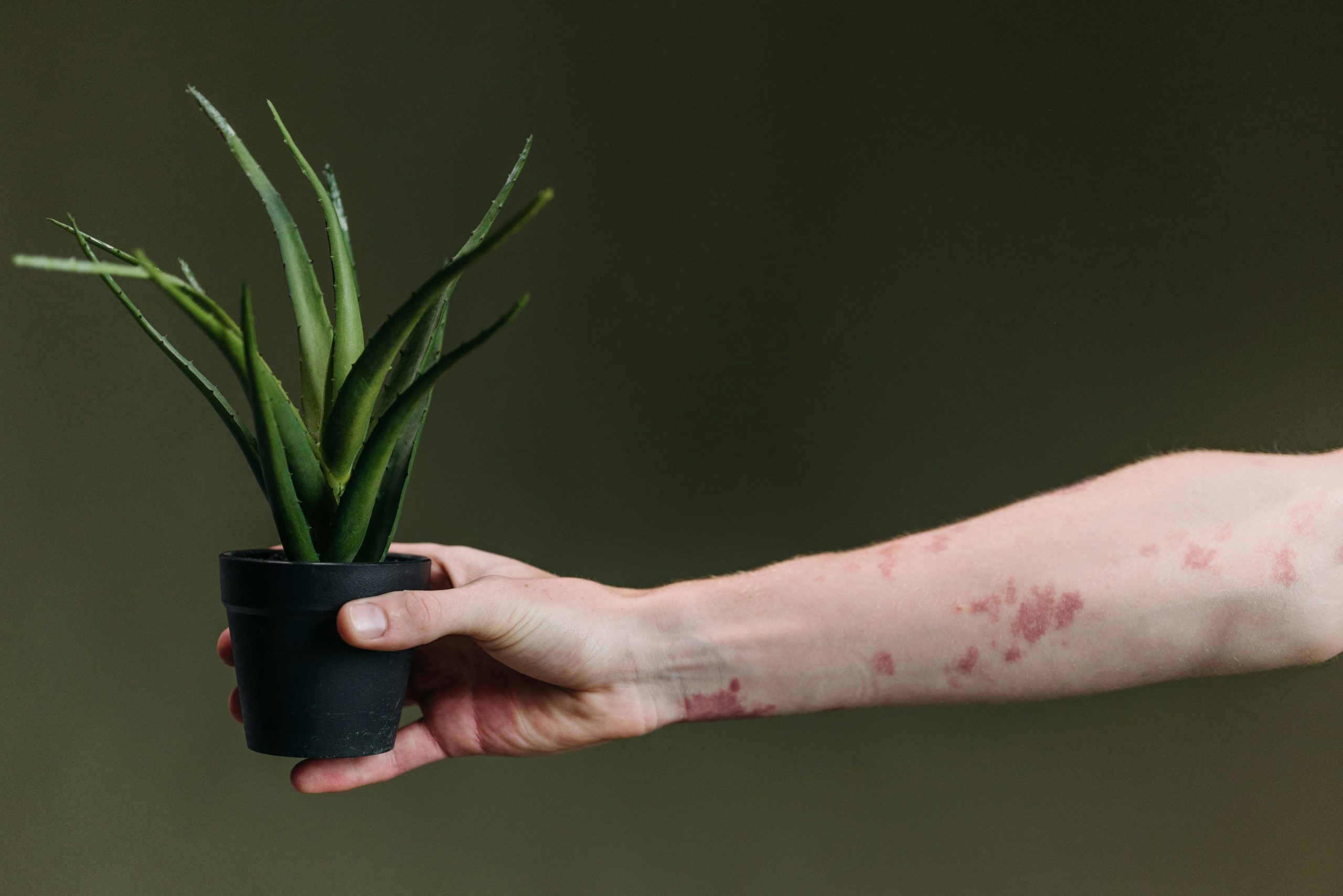 Person with eczema on their arm holding a potted plant